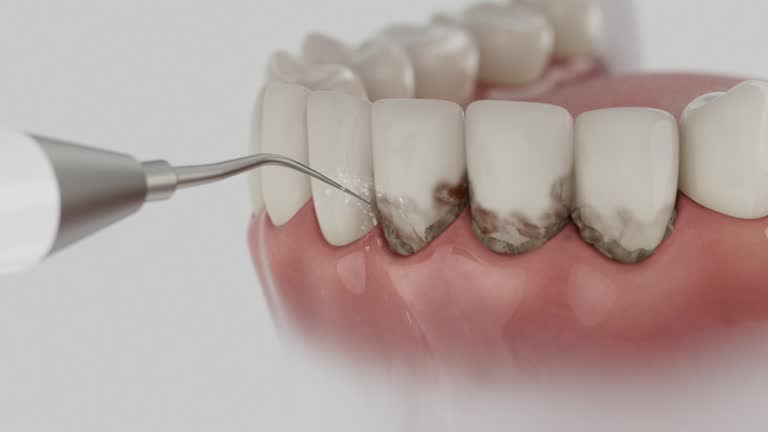 Reliable Dental contractor in Coppell, TX by Smile Center Dentistry